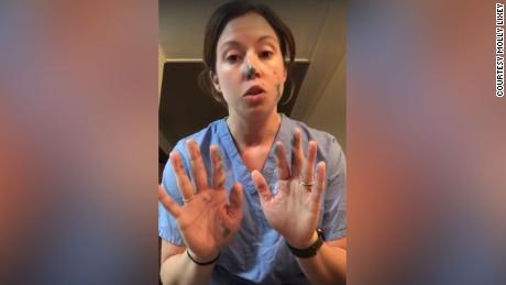 This nurse shows how quickly the germs spread even if you wear gloves