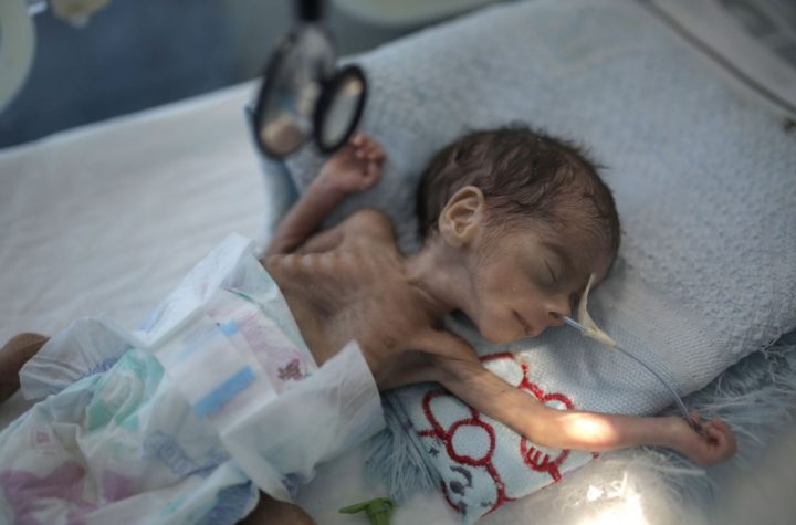 FILE - In this Nov. 23, 2019 file photo, a malnourished newborn baby lies in an incubator at Al-Sabeen hospital in Sanaa, Yemen. The U.N. children’s agency says that millions of Yemeni children could be pushed to “the brink of starvation” as the coronavirus pandemic sweeps across the war-torn Arab country amid a huge drop in humanitarian aid funding. UNICEF on Friday, June 26, 2020 released a new report, “Yemen five years on: Children, conflict and COVID-19.” (AP Photo/Hani Mohammed, File)