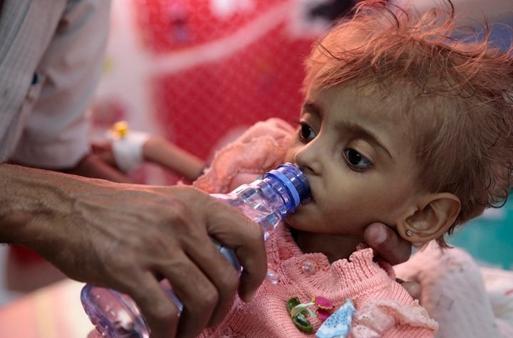UN: Millions of Yemeni children on the 'brink of starvation' | Yemen News