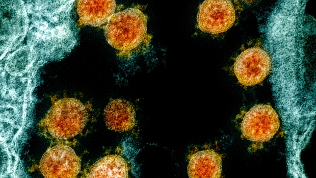 Saskatchewan reports 20 new coronavirus cases