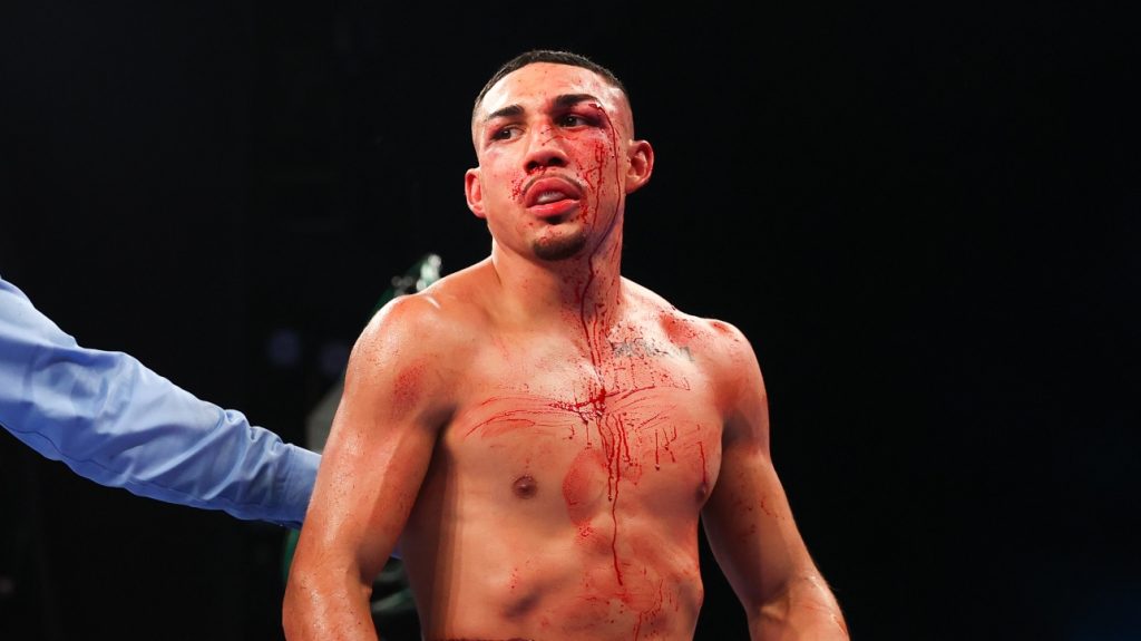 Boxing: Theofimo Lopez "may be dead" in the ring during a fight with Jorge Combosos