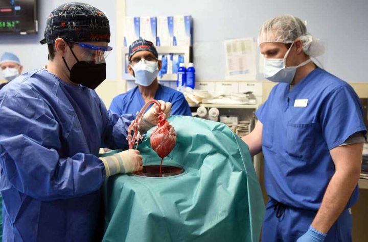 Pig heart transplant: a feat, but progress is still uncertain, experts say