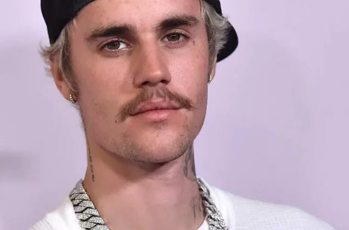 Justin Bieber has canceled his concerts again after suffering from facial paralysis