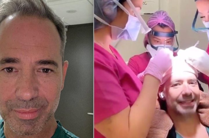 Jose Gaudet has gone out and shared all the photos of his hair transplant