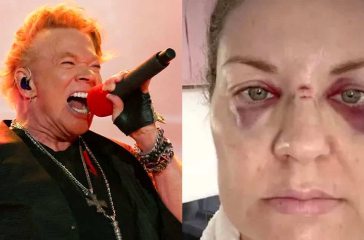 A microphone thrown by Axl Rose hits a woman in the face and leaves traces