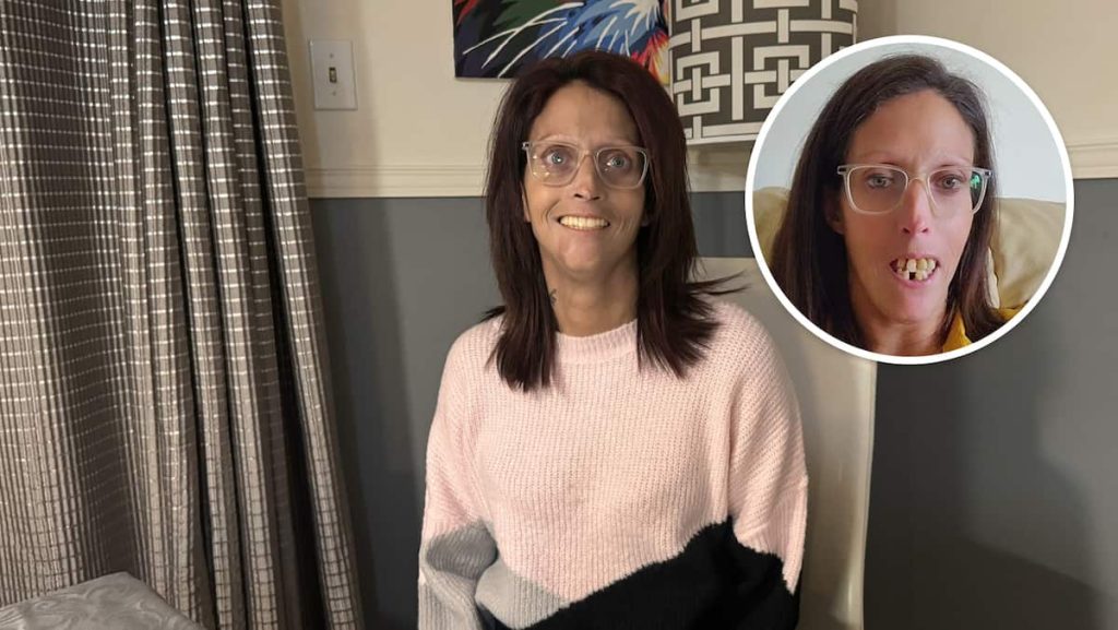 "I was dead inside, now I feel alive": She undergoes surgery thanks to charity on TikTok